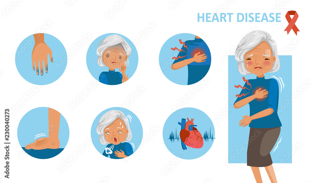 Heart disease and heart attack symptoms. Old woman standing hand holding chest  pain. Cyanosis of hand, feelling weak, swelling of feet, trouble breathing,  palpitation, Cartoon in circle infographic. Stock Vector | Adobe