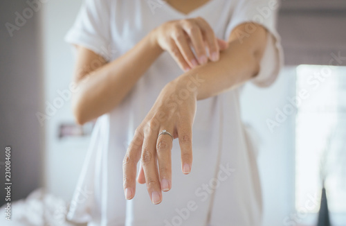 Woman with rash or papule and scratchon her arm from allergies,Health allergy skin care problem