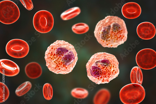 Eosinophilia, blood smear showing multiple eosinophils surround by red blood cells, 3D illustration. Eosinophilia occurs in parasitic and fungal infections, allergies, autoimmune disorders, tumors photo
