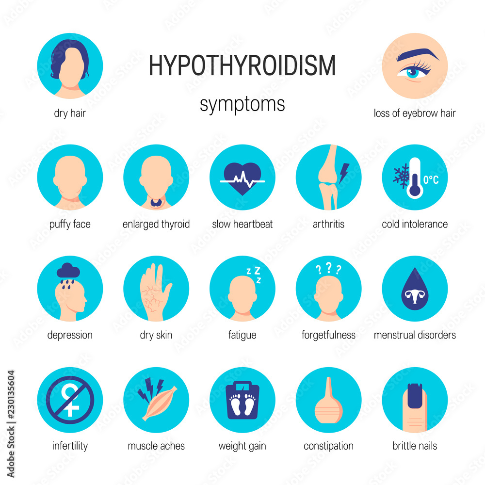Hypothyroidism symptoms vector Hypothyroidism symptoms vector