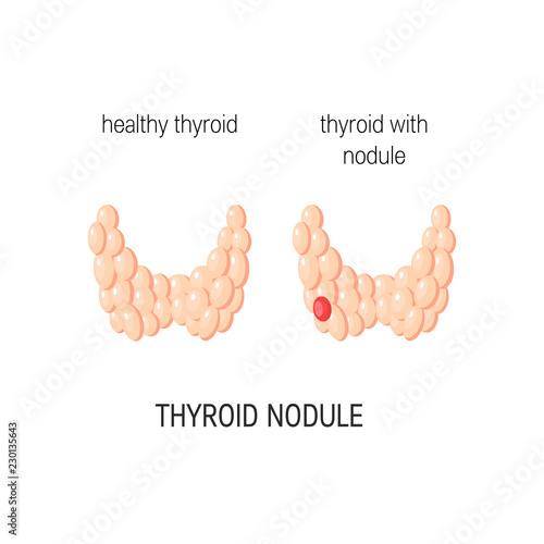Thyroid gland vector