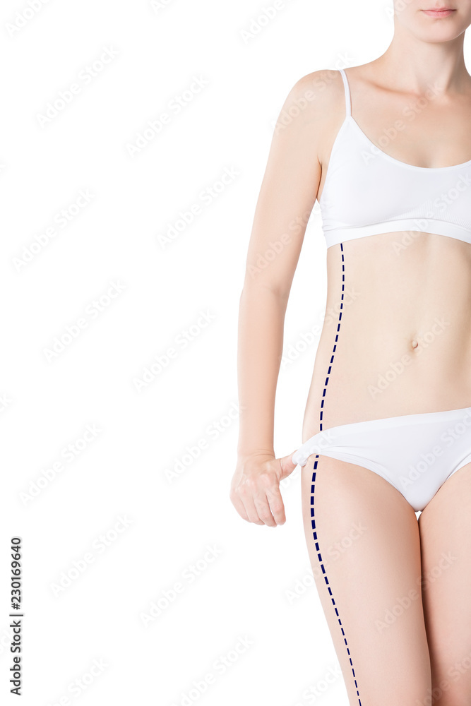 Liposuction, fat and cellulite removal concept, overweight female body with painted lines and arrows