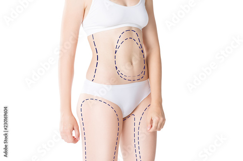 Liposuction, fat and cellulite removal concept, overweight female body with painted lines and arrows