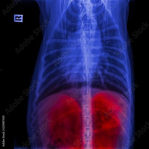 X-ray of dog anterior view closed up in thorax standard and chest with red highlight in liver system- veterinary medicine and Veterinary anatomy concept