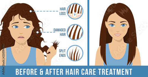 Hair care. Common hair problems - split ends, damaged hair, hair loss. Before and after hair care treatment. Vector