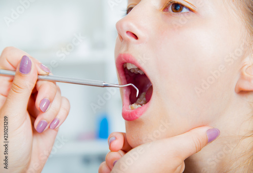 Close-up of little girl opening his mouth wide during treating...