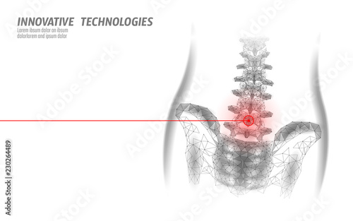 Human spine hip lumbar radiculitis pain low poly. Geometric polygonal particle triangle point line future medicine technology white red painful area vector illustration
