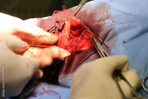 Surgical intervention by perineal hernia by dog (hernia involving the perineum) photo