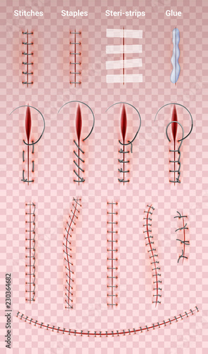 Surgical Suture Stitches Set