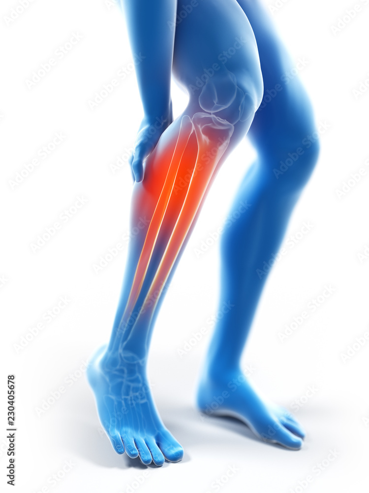 3d rendered illustration of a man having a painful calf 3d rendered illustration of a man having a painful calf