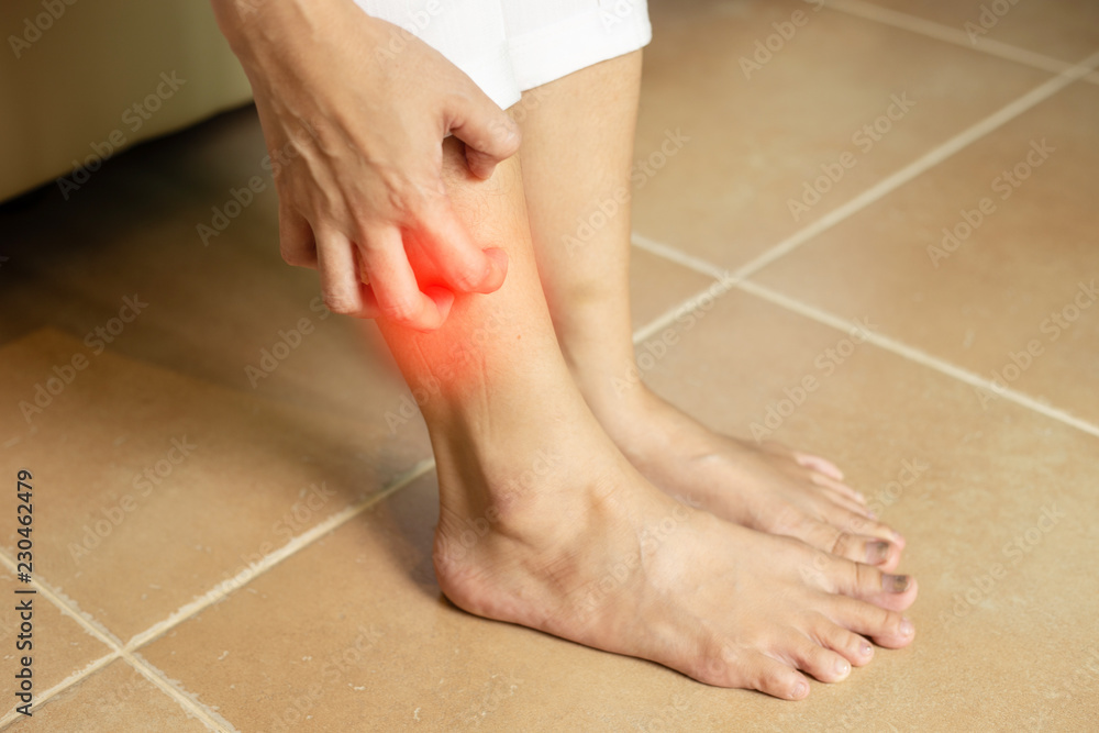 Woman itch leg skin and scratch and have problem with skin,Skincare Concept Woman itch leg skin and scratch and have problem with skin,Skincare Concept
