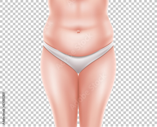 Vector liposuction surgery before woman body 3d