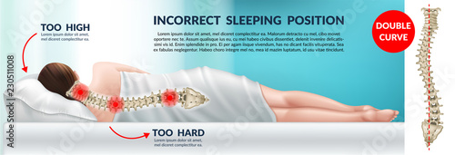 Advertising poster incorrect posture for sleep on a high pillow and hard mattress. Wrong position cervical vertebrae. Spinal curvature. 3d realistic vector illustration.