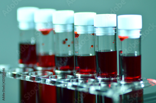 Blood laboratory tests