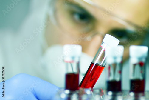 Cuadro en lienzo Blood laboratory tests