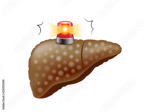 Human liver symbol with siren. Internal organ requires care or medical treatment due to disease or impact of adverse on health. health care concept. Vector illustration isolated on white background.