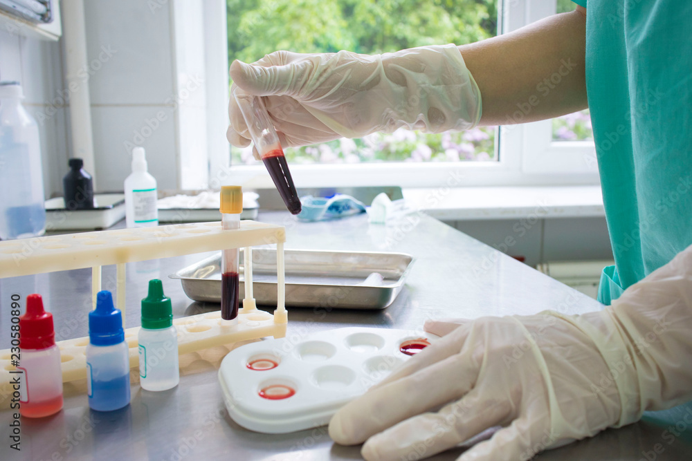doctor determines the blood group in the treatment room on the medical table doctor determines the blood group in the treatment room on the medical table