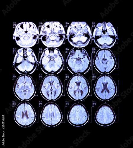 Radiograph Neuroimaging of Brain - Head Medical Monitoring - Xray, MRI, CT Diagnostic Scan Background

