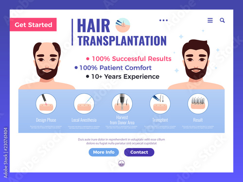 Hair Transplantation Web Banner