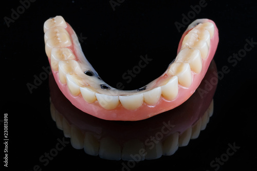 Dental prosthesis on the six screws after implantation, shot from the front on a black glass