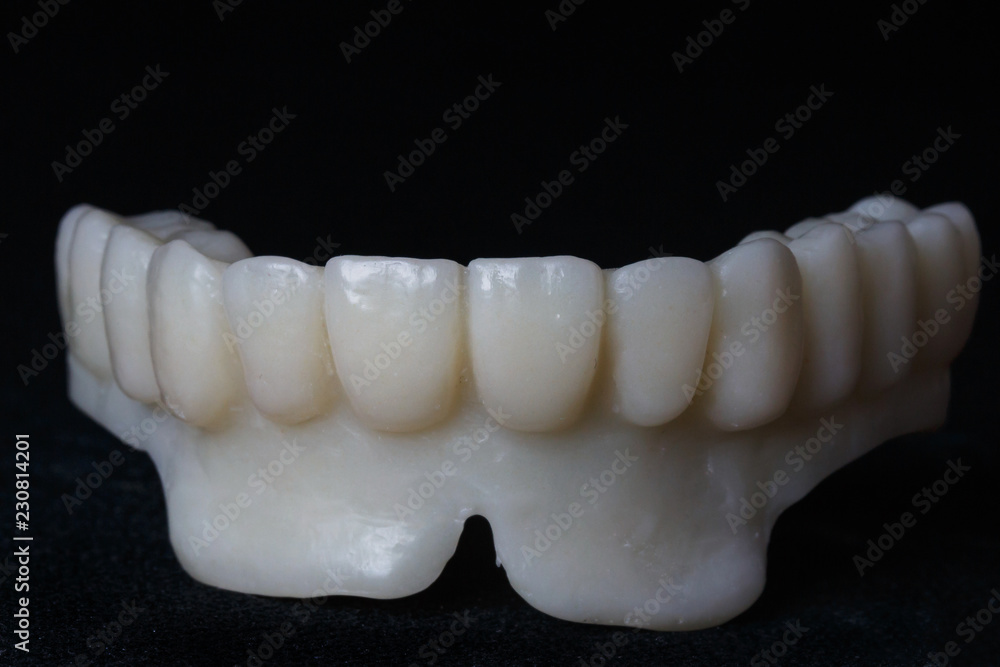 temporal structure of the upper jaw of the polymer temporal structure of the upper jaw of the polymer