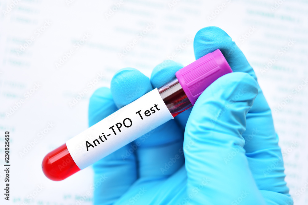 Blood Sample Tube For Anti TPO Or Anti thyroid Peroxidase Test blood-sample-tube-for-anti-tpo-or-anti-thyroid-peroxidase-test