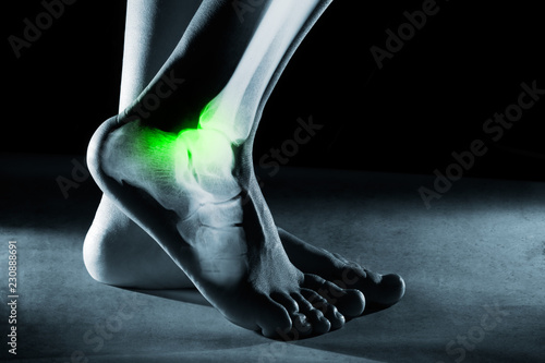 Human foot ankle and leg in x-ray, on gray background. The foot ankle is highlighted by green colour. © hamara