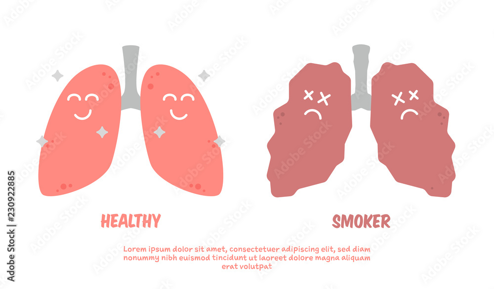 Healthy and smoker lung cartoon illustration poster comparison Stock Vector  | Adobe Stock