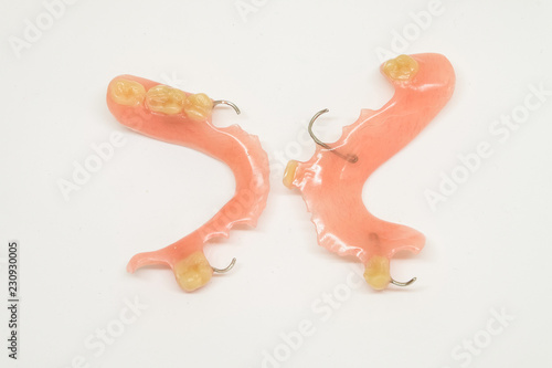 upper and lower partial denture