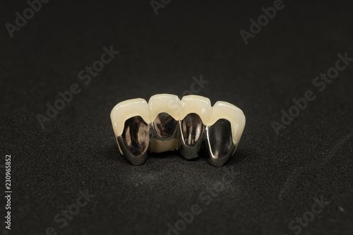 dental crown and bridge of lower incisor teeth on black background
