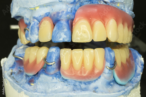 artificial teeth arrangement of removable denture