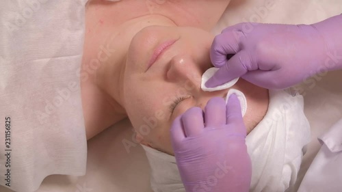 European middle-aged woman on a cosmetic procedure.A professional cosmetologist in lilac gloves wipes the skin of a female face around the eyes, neck and cheeks using cotton pads.Highquality raw video photo