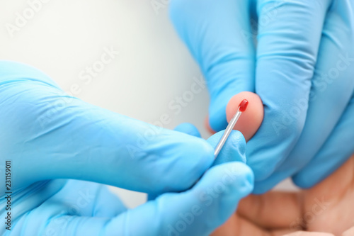 Doctor using lancet to get blood sample for test, closeup