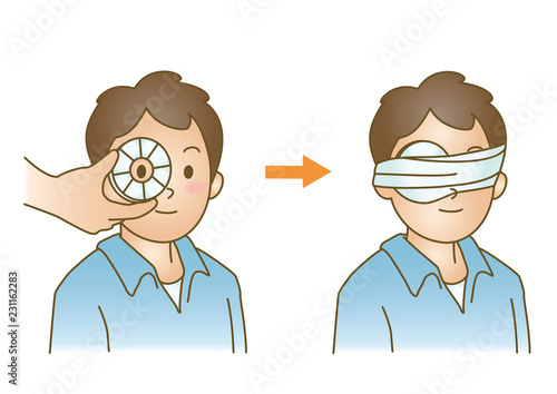 応急手当イラスト58：目の異物・ガラスなどの破片