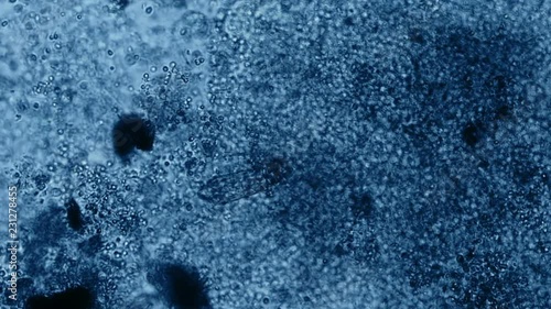 Protozoa Rotifer Feeding Microscope Blue Filter 200x photo