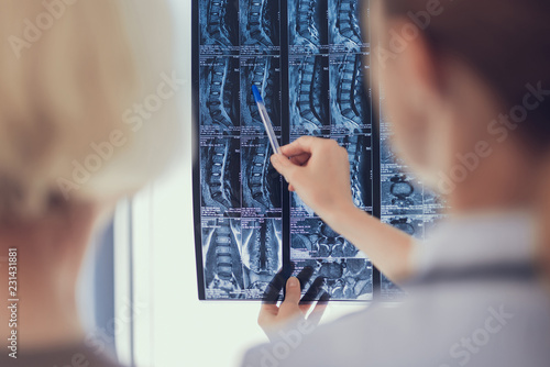 Focus on close-up of spine radiography being observed by surgeon. Female practitioner and lady are standing in front of photo and looking at it