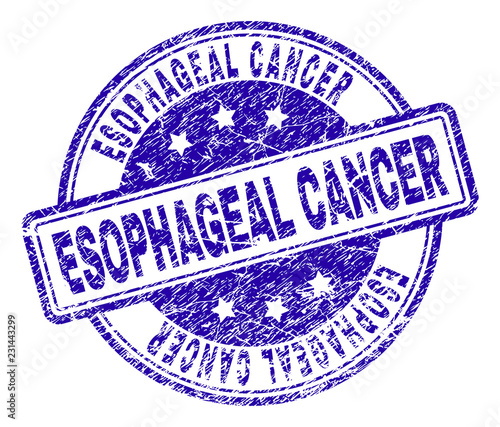 ESOPHAGEAL CANCER stamp seal imprint with grunge texture. Designed with rounded rectangles and circles. Blue vector rubber print of ESOPHAGEAL CANCER title with dirty texture.