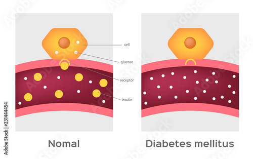 Insulin type / normal physiology , diabetes / unlocks the cell's glucose channel animation graphic
