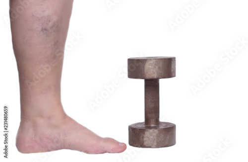 Leg of an elderly woman on a white background with varicose veins, near an iron dumbbell, heaviness in the legs, the concept of varicose veins in the legs, phlebeurysm