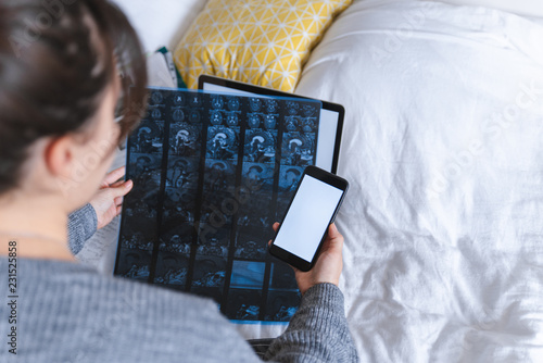 Foto woman looking of magnetic resonance imaging result and holding phone with white