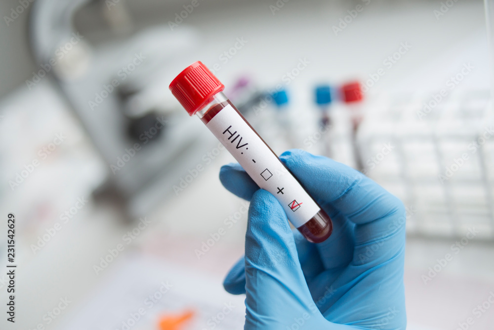 Fototapeta premium Diagnostician holding in hand a positive HIV test.