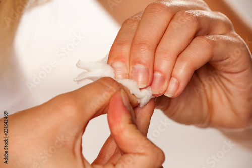 woman removing a nail polish with cotton pad and aceone photo