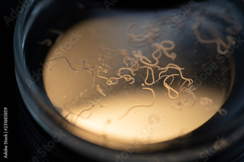 Foto Ascariasis is a disease caused by the parasitic roundworm Ascaris lumbricoides for education in laboratories