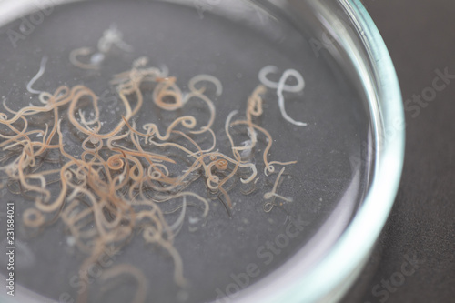 Ascariasis is a disease caused by the parasitic roundworm Ascaris lumbricoides for education in laboratories.