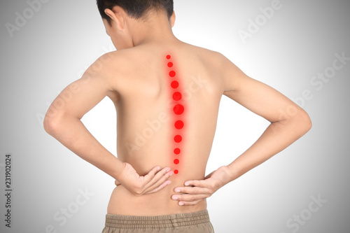 Asian kid with scoliosis, isolated on white background photo