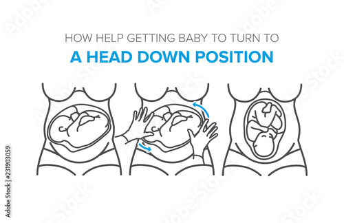 turn baby to a head down position in the womb