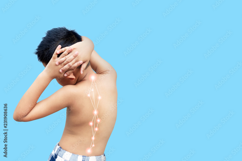 Asian kid with scoliosis, isolated on white background Asian kid with scoliosis, isolated on white background