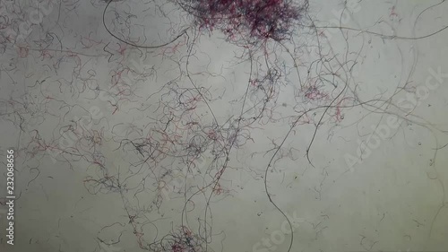 Synthetic fibers released from fabrics clothing in the form of microscopic plastic fibers every time we wash our laundry. The fibers damage the stomach of fish and seafood