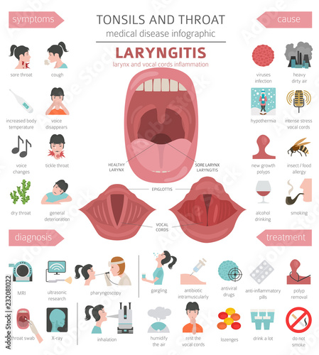 Tonsils and throat diseases. Laryngitis symptoms, treatment icon set. Medical infographic design photo