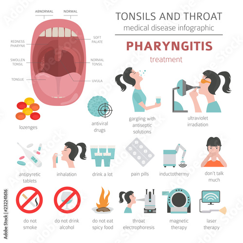 Tonsils and throat diseases. Pharyngitis symptoms, treatment icon set. Medical infographic design